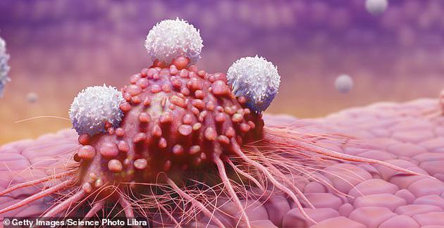 癌症新疗法:用别人的免疫细胞
